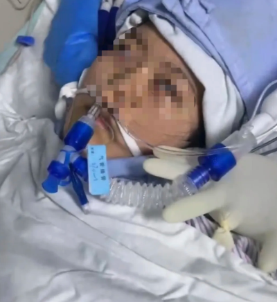 Bwin必赢下载22岁女子手术成功后脑死亡家属：缺氧30分钟医生未发觉医院回应(图1)